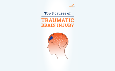 Unveiling the Causes of TBIs: Prevention and Recovery Insights for Brain Injury Awareness Month