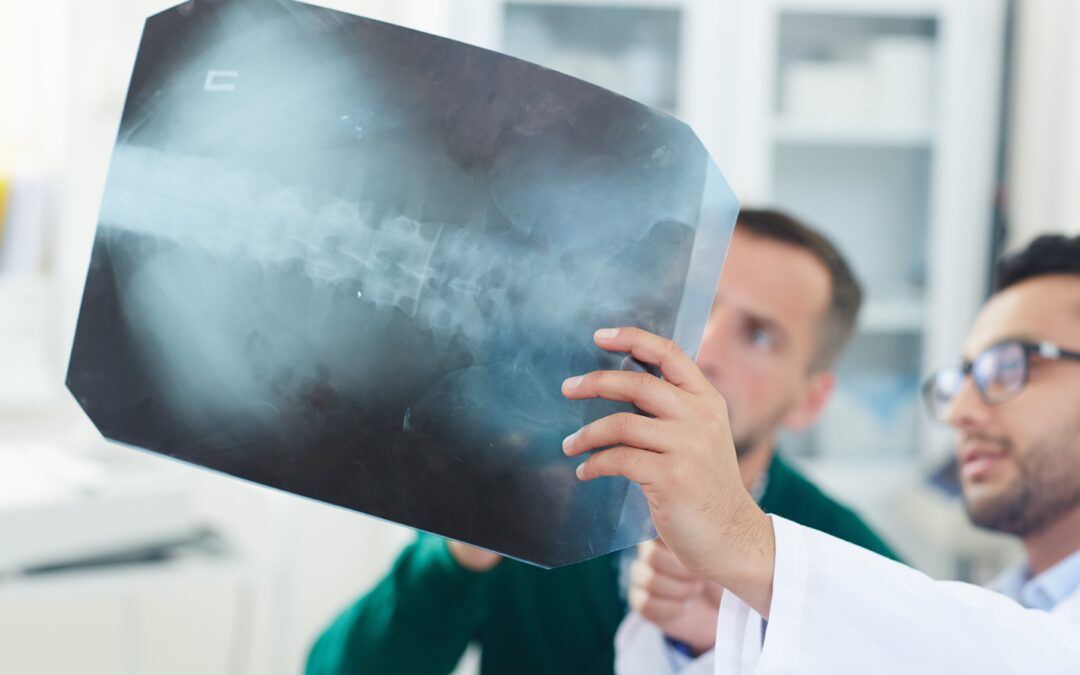 NeuroAiD has shown favourable outcome in patients suffering from spinal cord injuries