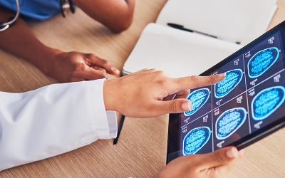 How neurorepair is critical for recovery