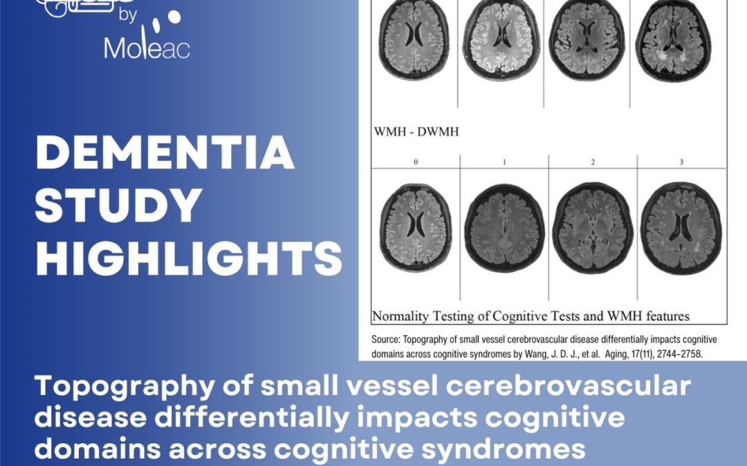 Dementia Study Highlights: How White Matter Hyperintensity Topography Impacts Cognitive Domains